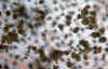 Oodinium4.jpg (88268 byte)